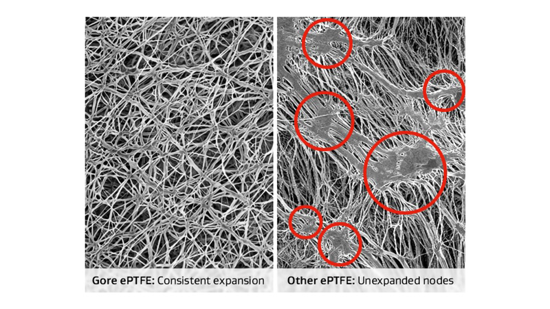 Gore ePTFE vs Other ePTFE